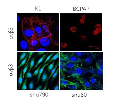 갑상선암 세포주 (BCPAP, K1, Snu790, Snu80)에서 αvβ3 antibody (LM609)에 의해 면역형광염색 확인 결과 대부분 세포막에서 & 일부 세포질에서 αvβ3가 발현됨