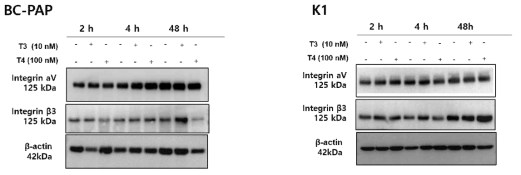 갑상선호르몬 처치에 의한 integrin αvβ3 단백질 발현. 갑상선유두암 세포주 BCPAP, K1에 갑상선호르몬 T3와 T4를 2h, 4h, 24h 처치 한 후 integrin av, integrin β3의 단백질 발현을 western blotting으로 확인 한 결과 integrin av에서는 시간에 따른 약간의 증가외에 발현 차이가 없었으나 K1 세포주에서 integrin β3는 T3 10nM,T4 100nM 모두에서 control에 비해서 단백질 발현이 증가됨
