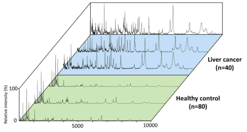 정상인 및 간암환자의 MALDI 프로파일의 일관성 확인