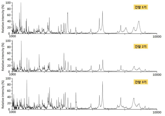 간암 stage 사이의 MALDI-MS 프로파일 비교