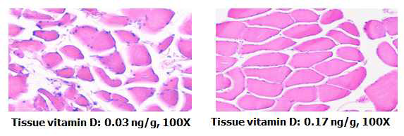 근육 내 Vitamin D가 높을수록 근섬유 면적이 큼을 보여주고 있다