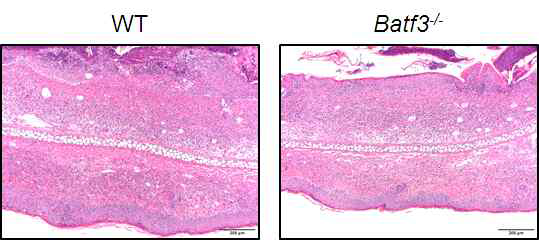 Batf3-/- 마우스에서 조직학적인 염증 소견이 감소함