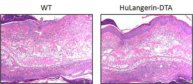huLangerin-DTA 마우스에서 조직학적인 염증 소견이 감소하지 않음