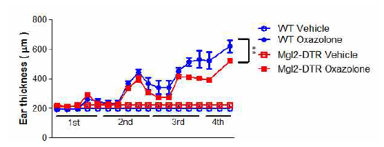 DT를 처리한 Mgl2-DTR 마우스에서 oxazolone에 의한 만성 알레르기성 접촉피부염 귀두께 감소가 acute 및 chronic phase에서 나타남 (**P < 0.01, Wilcoxon singed rank test)