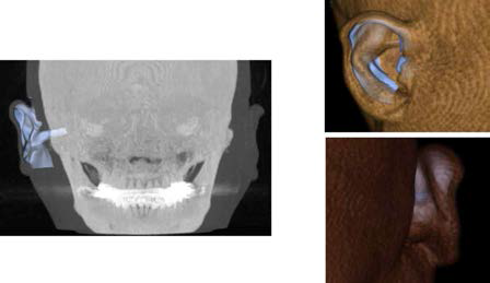 Scaffold image processing