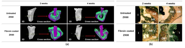 피브로인 코팅 시편의 rat에서의 매식시험 후 (a) Micro-CT 및 (b) 조직학적 분석결과