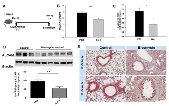 폐섬유와 모델에서 ALCAM 발현의 감소 (A) 폐섬유화 모델 개략도 (B) 기관지 폐포 세척액에서 ALCAM 발현양을 ELISA로 측정 (C) 폐 조직의 ALCAM의 mRNA level을 real-time PCR로 측정 (D) 마우스 폐 조직의 ALCAM의 단백질 level을 Western blot으로 분석 (E) 마우스 폐 조직에서 ALCAM에 대한 immunohistochemistry 염색 분석
