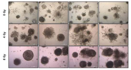 방사선조사에 따른 spheroid 형성 증가