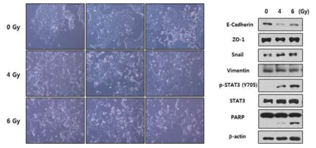 방사선조사에 따른 세포의 현태 변화 및 관련 단백질 변화