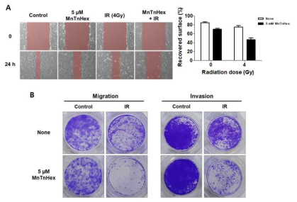 4T1 세포주에서 MnTnHex 와 X-선 병행처리에 의한 migration 및 invasion 감소효과 (A) Wound-healing assay. (B) Migration/invasion assay