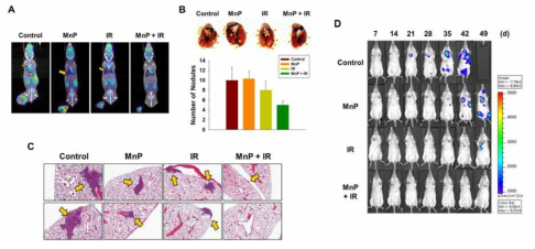 MnP와 방사선 병행처리에 의한 4T1 세포의 폐 전이 억제효과 (A) PET-CT 영상. (B) 폐조직에서의 Metatatic nodule. (C) H&E 염색. (D) IVIS 영상