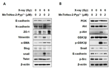 MnP와 방사선 병행처리에 의한 4T1 세포의 전이관련 단백질의 발현변화 (A) PET-CT 영상. (B) 폐조직에서의 Metatatic nodule. (C) H&E 염색. (D) IVIS 영상