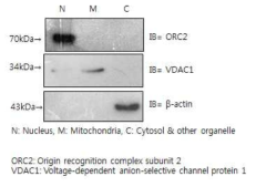 Cellular fraction의 western blot analysis. DNA 손상을 받은 세포 내에서 S3 펩타이드 프로브가 핵과 미토콘드리아 fraction (N+M fraction)에 거의 존재 한다는 것을 확인함