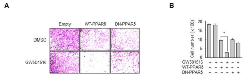 PPARδ의 활성화가 암세포 이주능에 미치는 영향