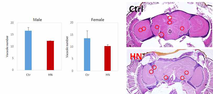 H&E staining 기법을 이용한 Elav-Gal4C155>hTauR406W 알츠하이머병 초파리 뇌의 공포(vacuole) 확인