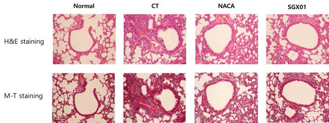 Effect of SGX01 on concentration of TNF-α (A), MIP2 (B), IL-17A (C) and CXCL-1 (D) production of BALF in LPS and CFD induced lung injury of mice
