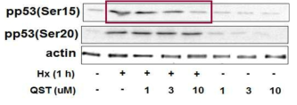 천연물 유래 성분 QST에 의한 p53 인산화 억제