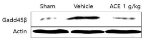 천연물 ACE에 의한 Gadd45β발현 억제 효능