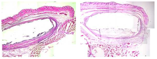 쥐의 피하에 이식된 전도성 스케폴드의 histology 결과 사진