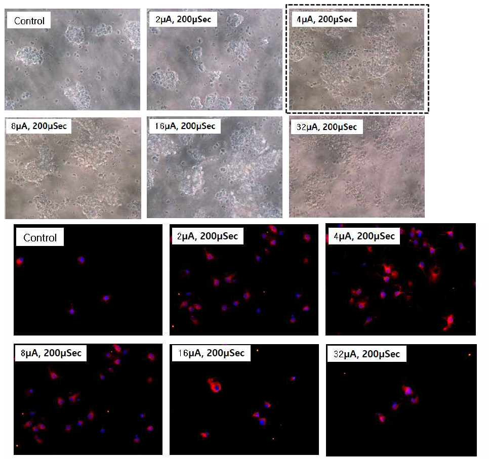 Tuj-1 + DAPI staining