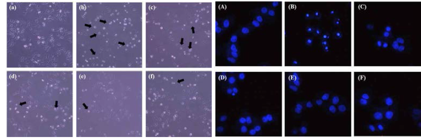 Protective effect on morphology change(left) and Hoechst staining (right). (a) Control, (b) t-BHP(100 μM), (c) LGSE(0.05 mg/mL)+t-BHP, (d) LGSE(0.1 mg/mL)+t-BHP, (e)LGSE(0.2 mg/mL)+t-BHP, (f) NAC (0.05 mg/mL)+t-BHP, 200X