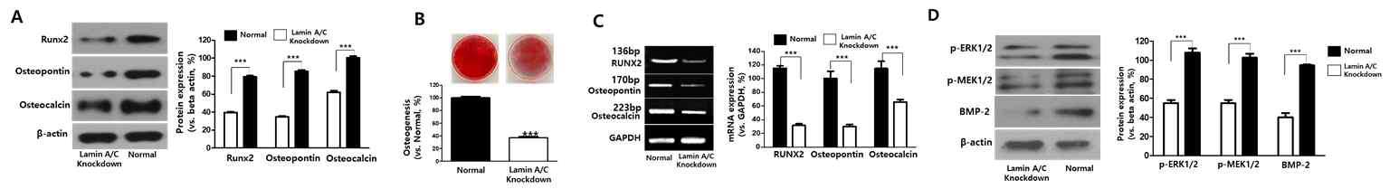 생쥐 siRNA를 이용한 Lamin A/C knockdown 통한 중간엽줄기세포의 골 분화능 확인. (A) 골 분화 관련 단백질 발현 비교. (B) Osteogenesis(골분화)의 Alizarin Red 염색. (C) 골 분화 관련 유전자 발현 확인. (D) 골 분화 기전 관련 단백질 발현 확인