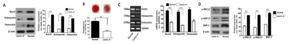 Lamin A 돌연변이 형질전환 생쥐 골수 유래 중간엽줄기세포의 골 분화능 확인. (A) 골 분화 관련 단백질 발현 비교. (B) Osteogenesis(골분화)의 Alizarin Red 염색. (C) 골 분화 관련 유전자 발현 확인. (D) 골 분화 기전 관련 단백질 발현 확인