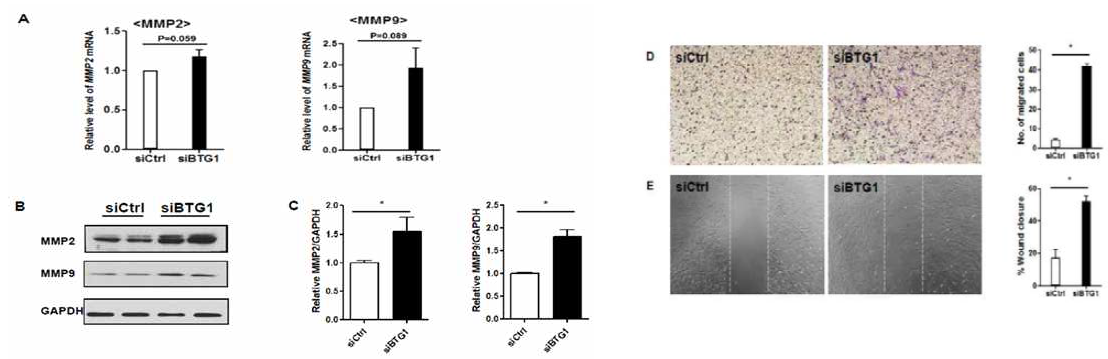 Evaluation of migration potentials of HESCs after BTG1 siRNA transfection. (A) mRNA expressions of MMP2 and MMP9 after vehicle (control) and BTG1 siRNA transfections of HESCs. N = 4; *, P < 0.01. (B and C) Protein expressions of MMP2 and MMP9 after vehicle (control) and BTG1 siRNA transfections of HESCs. N = 4; *, P < 0.01. (D) Migration (N = 4) and (E) wound healing assay (N = 4) of HESCs after BTG1 siRNA transfection. *, P < 0.01