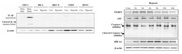 허혈자극시 신상피세포에서 IL-1β의 분비 없이 NLRP3 활성이 증가됨