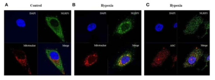 허혈자극시 HK-2세포 내 NLRP3 는 미토콘드리아로 이동