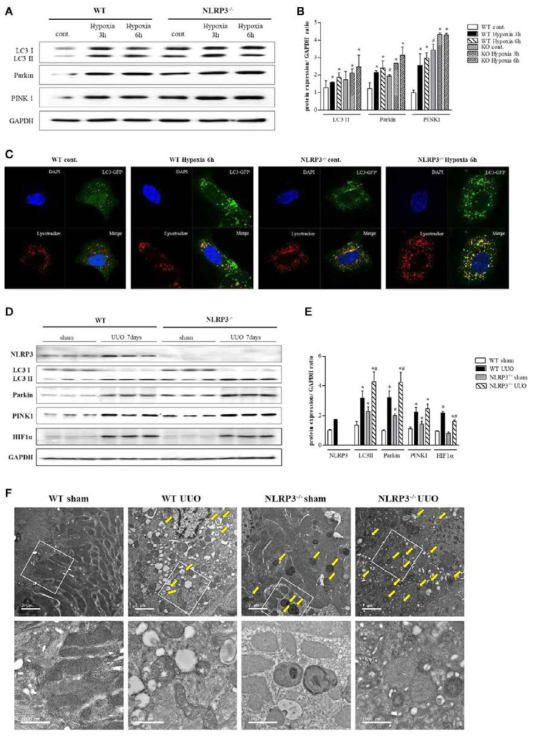 NLRP3 KO 세포 및 조직에서의 자극시 mitophagy 의 증가