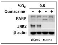 Effect of quinacerine on JNK2 activation-mediated cell death in cancer cells under hypoixa