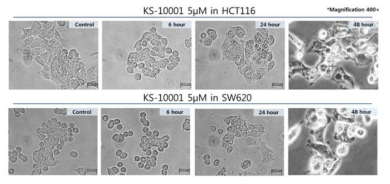 HCT116, SW620 대장암 세포에 대한 KS-10001의 세포 성장 억제 이미지