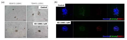 KS-10001 투여에 따른 오가노이드의 성장 억제 평가