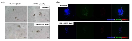 KS-10005 투여에 따른 오가노이드의 성장 억제 평가