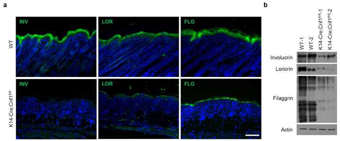 표피에서 미토콘드리아 기능장애가 분화에 미치는 영향. Crif1 결손에 의해 표피 분화 마커인 Involucrin (INV), Loricrin (LOR), Filaggrin (FLG)의 발현이 현저히 감소한 것을 면역 형광염색 및 Western blot을 통해 확인함