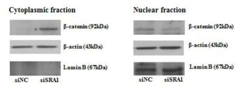 Wnt/β-catenin pathway mediates the oncogenic activity of siSRA1