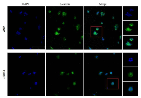 Wnt signaling pathway is activated in siNC and siSRA transfected ECC-1 cells