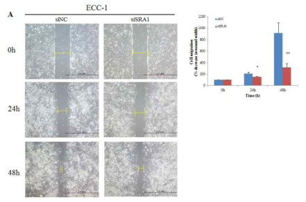 siSRA에 의한 ECC-1 cell migration 변화