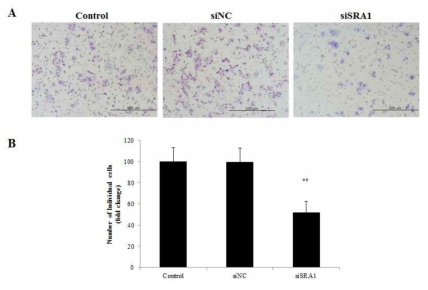 siSRA에 의한 ECC-1 cells의 invasion 변화