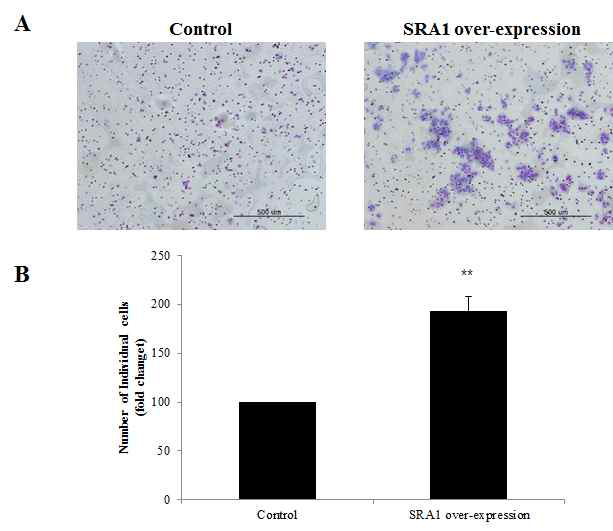 SRA overexpression에 의한 ECC-1 cells의 invasion