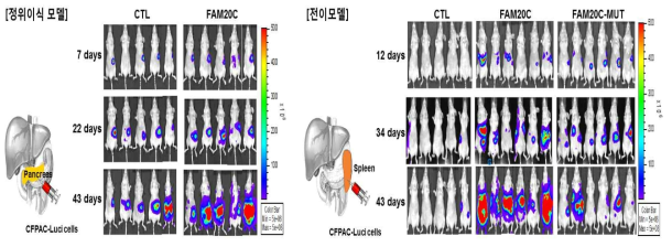 FAM20C에 의한 종양 성장 및 전이 가속화 양상