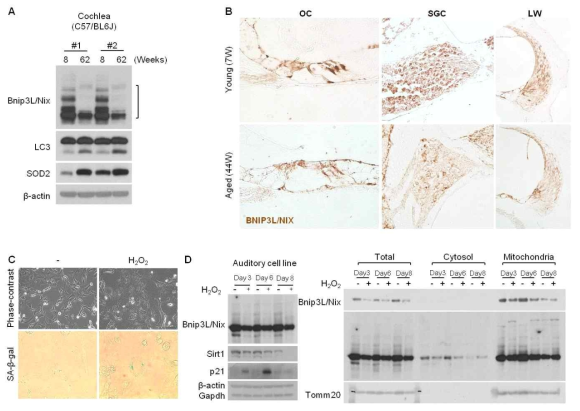 Bnip3L/Nix levels in young and old cochlear cells by western blot (A), and immunohistochemistry (B). SA-β-gal staining and protein levels of Bnip3L/Nix at day 3, 6 and 8 in HEI-OC1 cells after cellular senescence