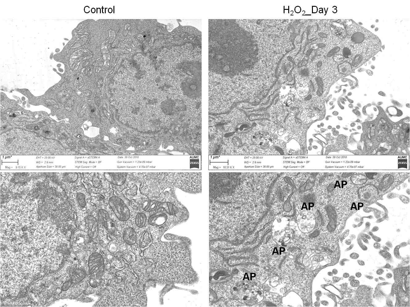 Transmission electron microscopy (TEM) images of HEI-OC1 cells treated with D.W and H2O2 at day 3. AP: Autophagosome