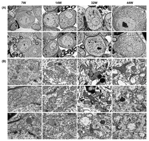 TEM images at low (A, 5000 nm) and high　(B, 1000 nm) magnification of spiral ganglion cells at different ages (7, 14, 32 and 44 weeks)