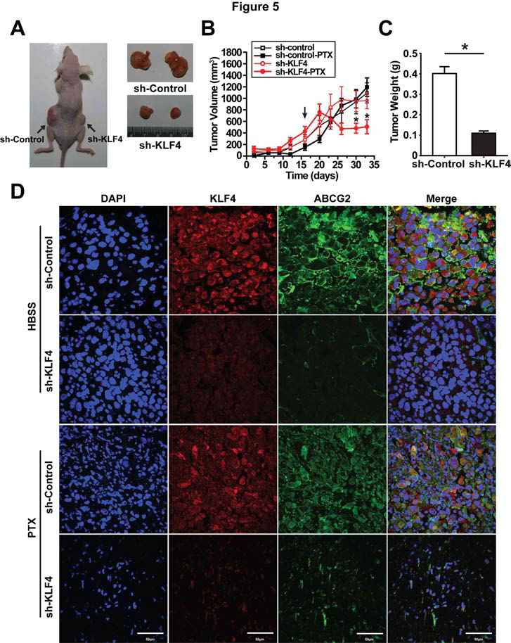 미분화 갑상선암 유래 Tumor xenografts model에서 KLF4의 영향