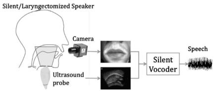 카메라 영상과 초음파 영상을 이용한 음성합성기의 블록도
