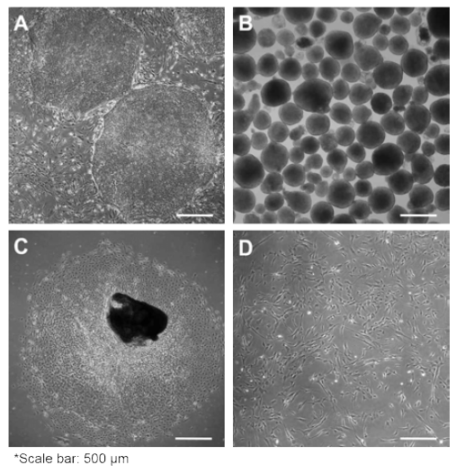 인간만능줄기세포 유래의 간엽줄기세포로의 분화법 연구 (A) 쥐섬유모세포 (mouse embryonic fibroblast, MEF) feeder layer위에 배양된 미분화된 상태의 인간만능줄기세포 (H9 세포) (B) Ultra low binding plate에서 9일간 suspension 배양기법을 통해 형성된 embryoid body (C) embryoid body의 monolayer 배양을 통해, 새로이 자라나는 세포들이 embryoid body 주변에서 관찰됨 (D) 인간만능줄기세포 유래에서 간엽줄기세포로 분화된 세포들의 morphology
