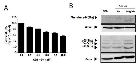 베타아밀로이드로 유도되는 신경세포 사멸 시 p66(Shc) 발현 및 인산화 변동