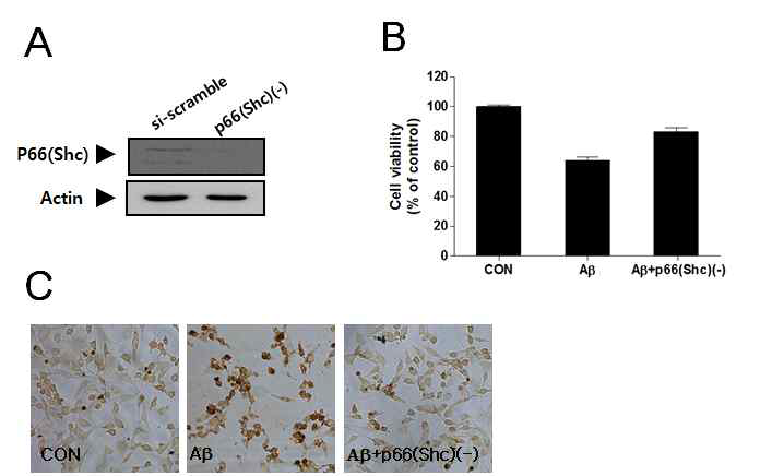 p66(Shc) 발현억제가 베타아밀로이드로 유도된 신경세포사멸에 미치는 영향
